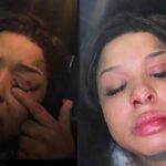 A Busted Lip and a Bruised Face Are Seen on Chrisean Rock’s Livestream