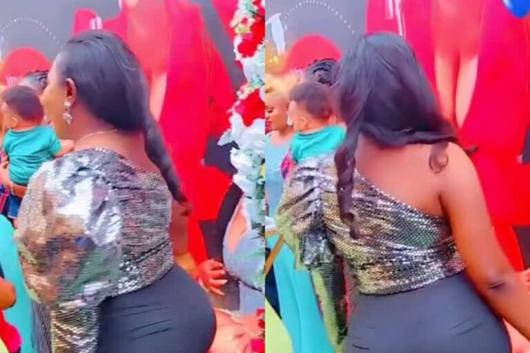 👀🍑 Woman Gets a BBL in Africa and Let’s Just Say It Ain’t Lookin’ Right Back There 😳