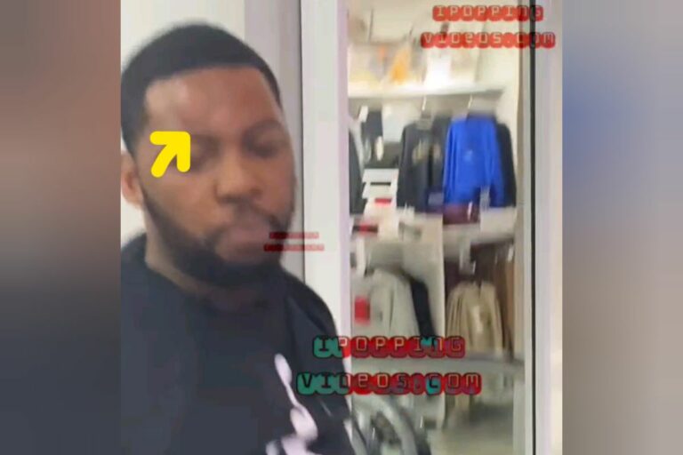 Employee At Champs Sports Engages In A Confrontation With A Customer, Resulting In The Employee Sustaining A Visible Swelling On His Forehead