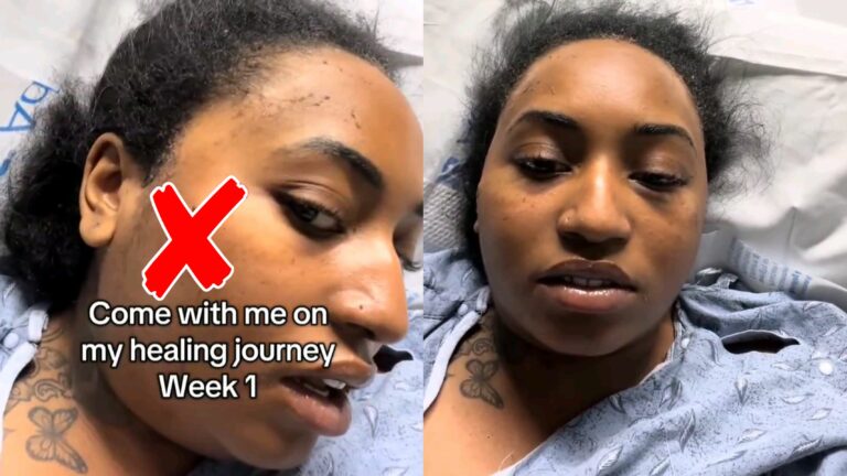 Against All Odds: Woman Regains Sight After Being Shot in the Head and Surviving Fiery Crash
